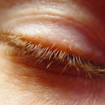 eyelid